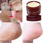 Cremă antifungică și reparatoare pentru picioare — Foot Repair &amp; Anti-Fungal Cream