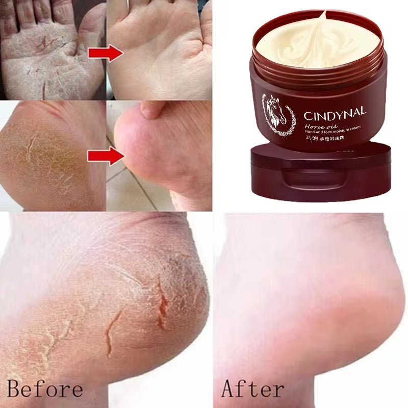 Cremă antifungică și reparatoare pentru picioare — Foot Repair &amp; Anti-Fungal Cream